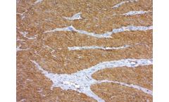 Scytek - Model 1A4 - Alpha-Smooth Muscle