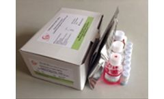 Model AFP - Quantitative Diagnostic kit