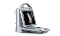 Kaixin - Model ODU5 - Ophthalmic A/B Ultrasound Scanner