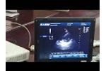 DCU30 Cardiac Testing Video