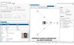 X-FIRE Lite - Investigation and Criminal Intelligence Database Software