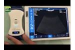 Revolutionary Double head wireless ultrasound probe device operation Video