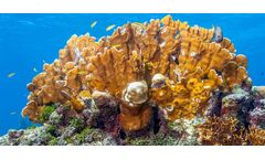 Investing in Wastewater Infrastructure Is Essential to Caribbean Tourism