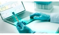 Boost Accuracy & Efficiency: Integrating Barcoding with LIMS Software
